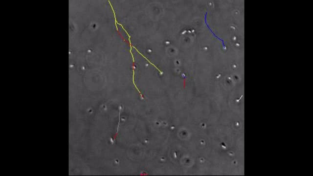 Mikrobiologie - E-coli